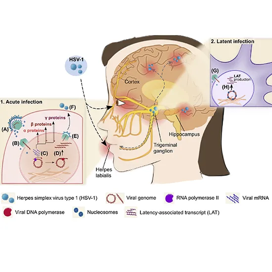 Herpes Simplex Virus